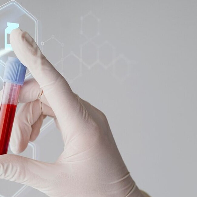 Análisis de toxicidad celular en sangre: clave para la salud integral