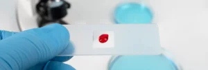 ¿Sabes qué tóxicos hay en tu sangre?
